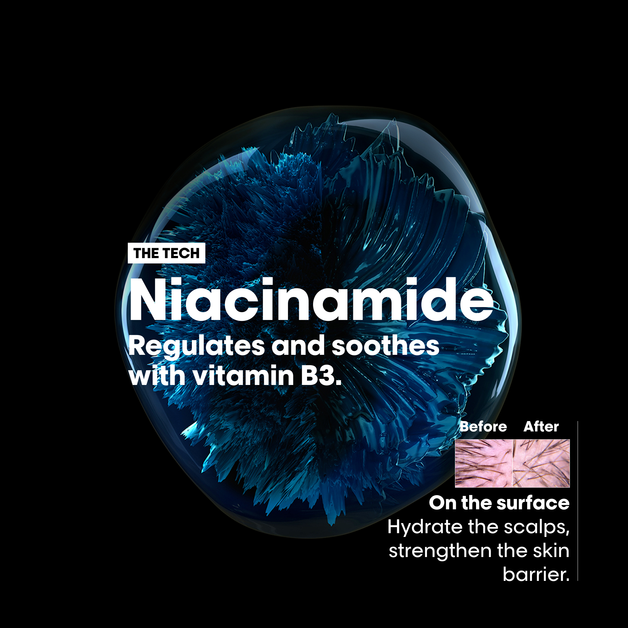 L’Oréal Professionnel Scalp Advanced Anti-Discomfort Dermo-Regulator Shampoo - Image 5